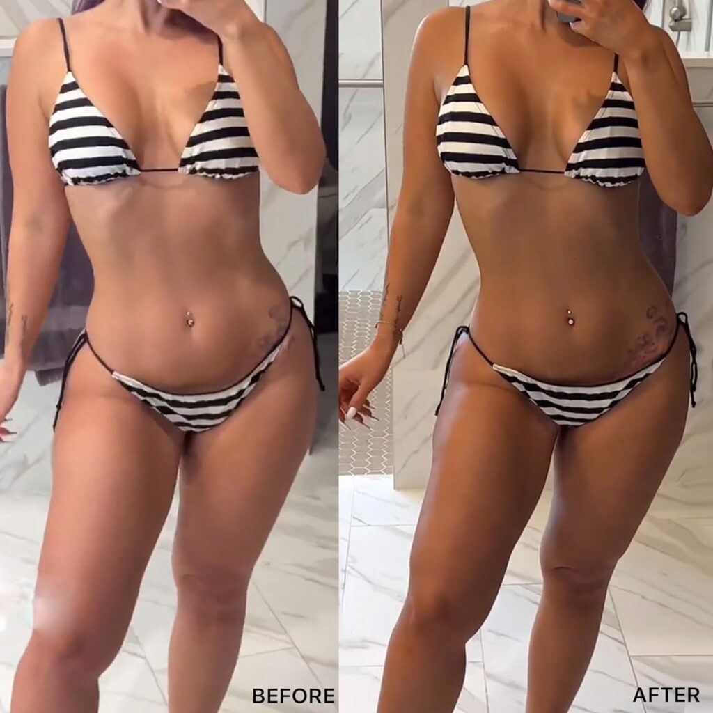 Before and after
